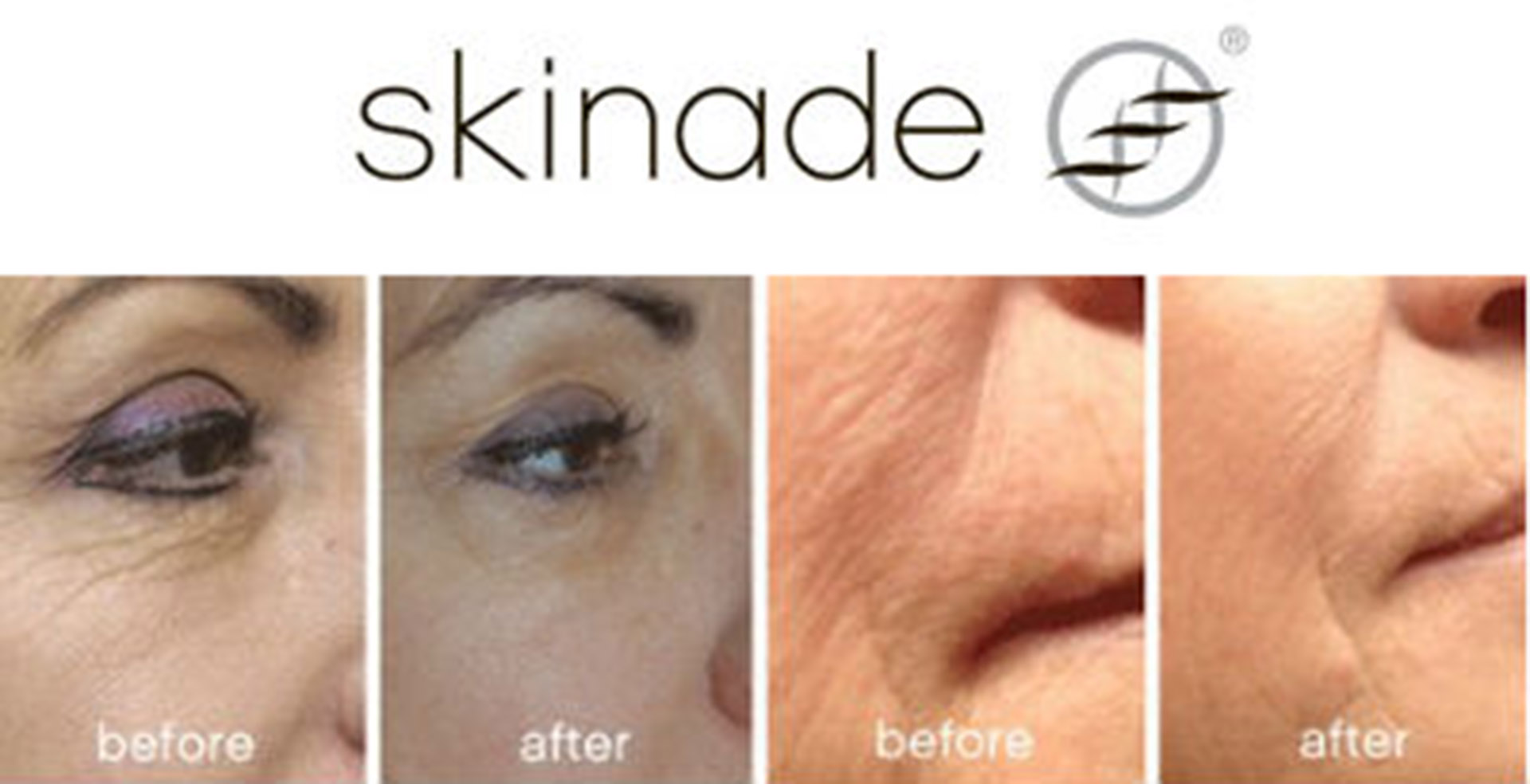 Skinade – One Way Solution For Your Skin